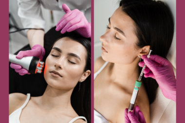Close-up of a lady undergoing a vampire facial treatment as part of their exclusive skincare routine for timeless beauty.