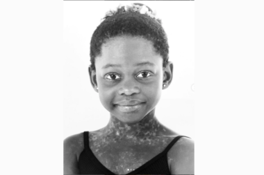 Michaela DePrince overcoming adversity to become a Black ballerina